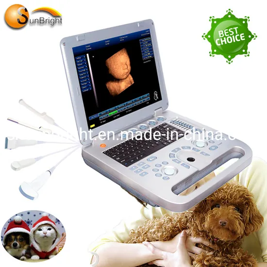 3D System Portable Ultrasound Scanner Price Affordable